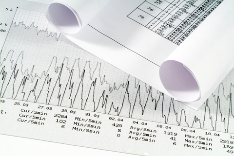 Hyster-Yale Materials Handling Inc, Oshkosh Corp's access equipment segment and Terex Corp show improvements. PHOTO: DREAMSTIME.COM